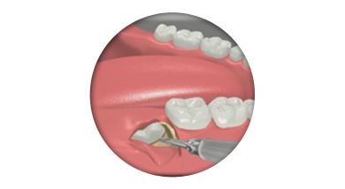 Dentist Estes Park